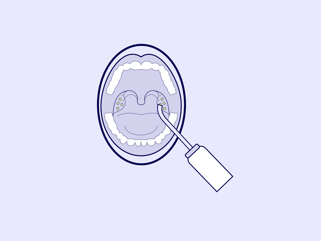 Tutorial: Versteckte Mandelsteine ausspülen