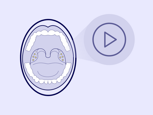 Mandelsteine entfernen - Videos